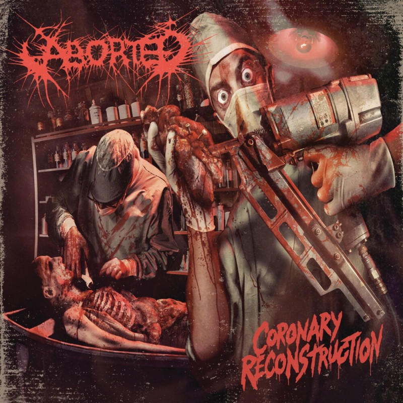 Aborted - Coronary Reconstruction (2. Hand, 12" EP)