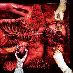 200 Stab Wounds - Manual...